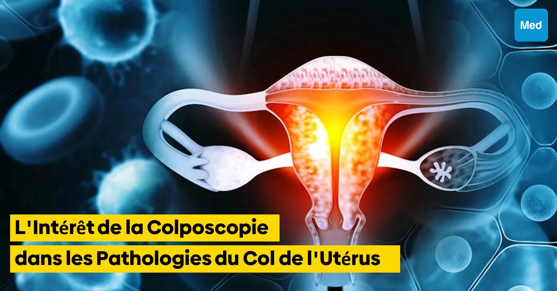 L'Intérêt de la Colposcopie dans les Pathologies du Col de l'Utérus
